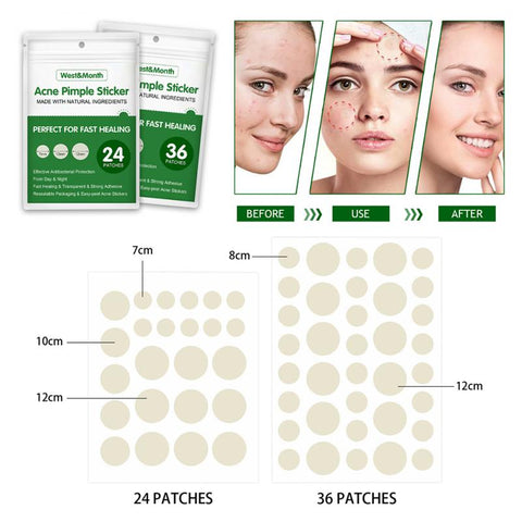 AcneCare®  Pimple Patches