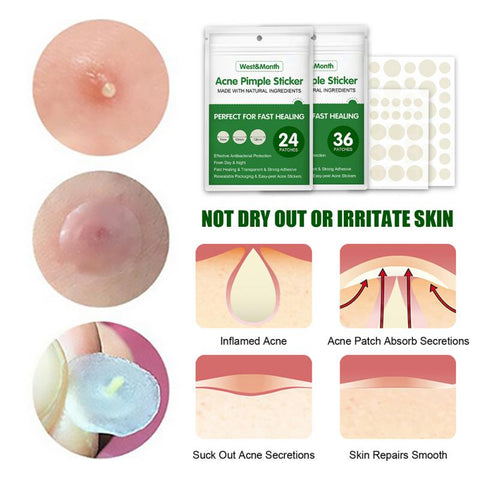 AcneCare®  Pimple Patches